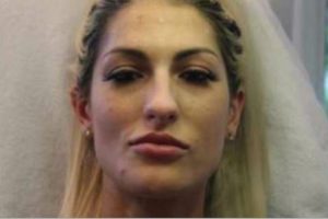 Lauren L. Klavano Botox Bandit Arrested Kirkland Washington