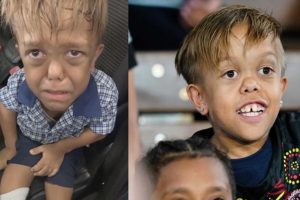Quaden Bayles Australian Boy Bullying Dwarfism