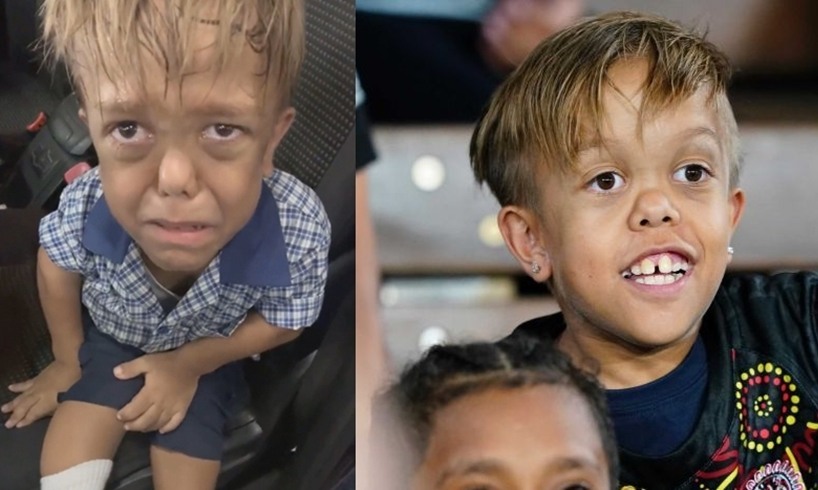 Quaden Bayles Australian Boy Bullying Dwarfism
